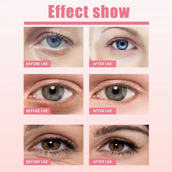 Rose Hyaluronic Acid Eye Cream Stick Moisturizing Anti-Aging Firming Eye Eye Dark Firming Circles Moisturizing Remove Bags